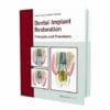 Dental Implant Restoration: Principles and Procedures (Scanned PDF)