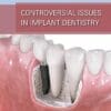 Controversial Issues in Implant Dentistry (Scanned PDF)