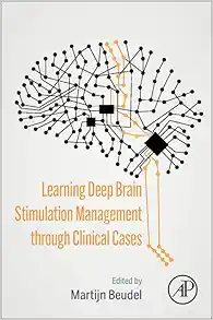 Learning Deep Brain Stimulation Management through Clinical Cases (EPUB)