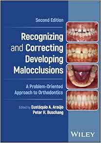 Recognizing and Correcting Developing Malocclusions: A Problem-Oriented Approach to Orthodontics, 2nd edition (PDF)