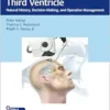 Colloid Cysts of the Third Ventricle: Natural History, Decision-Making, and Operative Management (Videos Only)