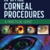 In-Office Corneal Procedures (EPUB)