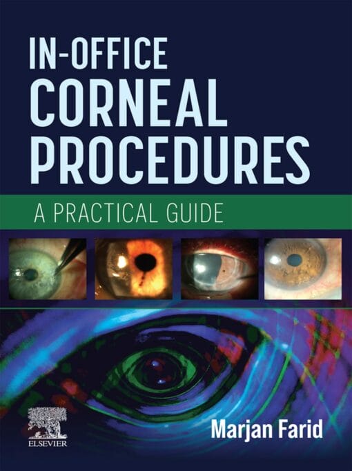 In-Office Corneal Procedures (EPUB)