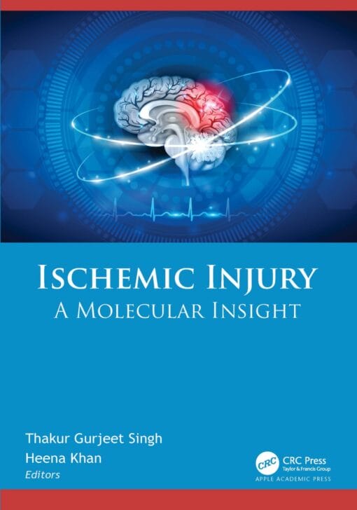 Ischemic Injury: A Molecular Insight (EPUB)