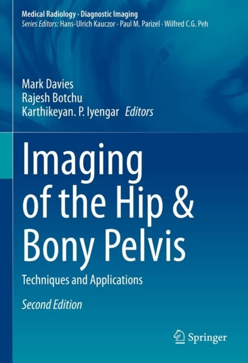 Imaging of the Hip & Bony Pelvis: Techniques and Applications, 2nd Edition (PDF)