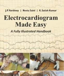 Electrocardiogram Made Easy: A Fully Illustrated Handbook (PDF)