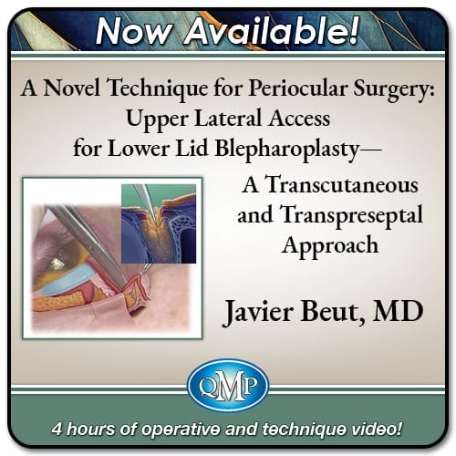 A Novel Technique for Periocular Surgery: Upper Lateral Access for Lower Lid Blepharoplasty – A Transcutaneous and Transpreseptal Approach 2024