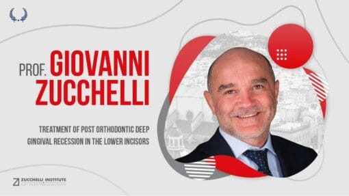 DentalLeaders Treatment of Post Orthodontic Deep Gingival Recession in the Lower Incisors – Giovanni Zucchelli