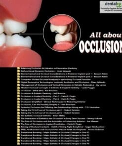 DentalXP All about Occlusion