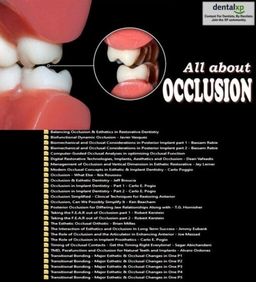 DentalXP All about Occlusion