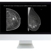 Everything, Everywhere, All At Once: A Comprehensive Breast Imaging Longitudinal Course (ARR course)