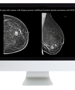 Everything, Everywhere, All At Once: A Comprehensive Breast Imaging Longitudinal Course (ARR course)