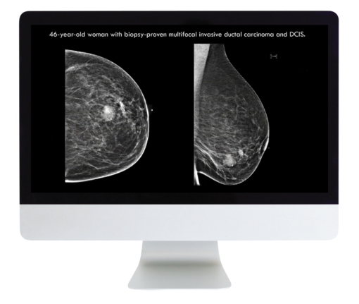 Everything, Everywhere, All At Once: A Comprehensive Breast Imaging Longitudinal Course (ARR course)