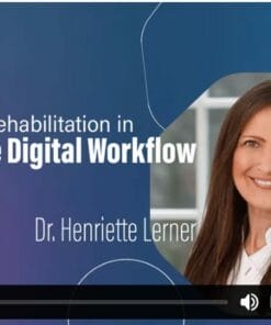 Full Arch Rehabilitation in Complete Digital Workflow