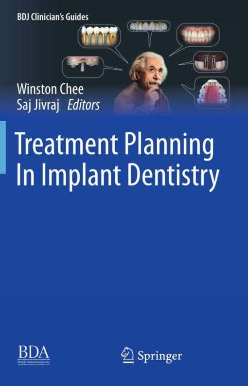 Treatment Planning In Implant Dentistry