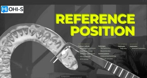 OHI-S Reference Position Centric Relation (CR), Centric Occlusion (CO), Neuro-Muscular RP