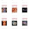 Ultrasound in Obstetrics & Gynecology 2024 Full Archives (PDF)