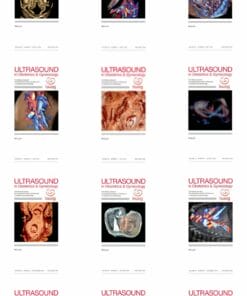 Ultrasound in Obstetrics & Gynecology 2024 Full Archives (PDF)