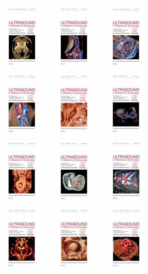 Ultrasound in Obstetrics & Gynecology 2024 Full Archives (PDF)