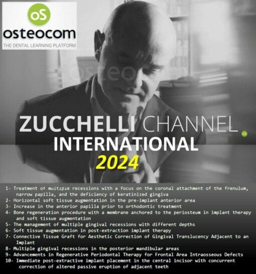 Zucchelli Channel International 2024 (New released update)