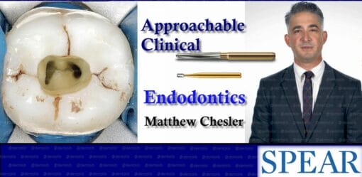 Spear Approachable Clinical Endodontics – Matthew Chesler