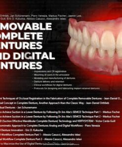 OHI-S Removable Complete Dentures and Digital Dentures