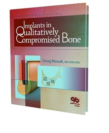 Implants In Qualitatively Compromised Bone (Scanned PDF)