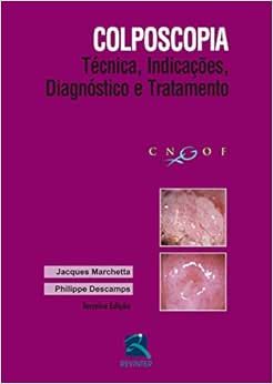 Colposcopia: Técnica, Indicações, Diagnóstico e Tratamento, 3rd Edition (PDF)