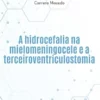 A hidrocefalia na mielomeningocele e a terceiroventriculostomia (Portuguese Edition) (EPUB)