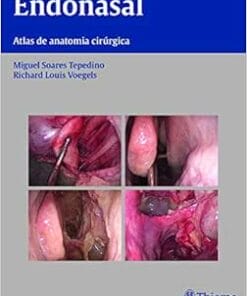 Endonasal: Atlas de Anatomia Cirúrgica, 1st Edition (PDF)