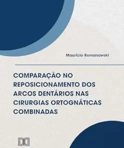 Comparação no reposicionamento dos arcos dentários nas cirurgias ortognáticas combinadas (Portuguese Edition) (EPUB)