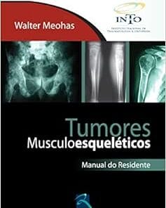 Tumores Musculoesqueléticos: Manual do Residente, 1st Edition (PDF)