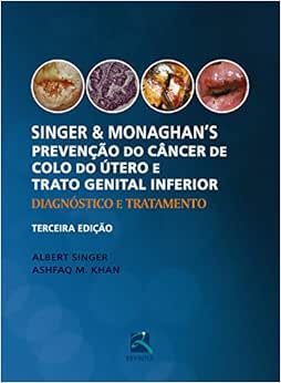 Singer e Monaghan’s Prevenção do Câncer de Colo do Útero e Trato Genital Inferior: Diagnóstico e Tratamento, 3rd Edition (PDF)