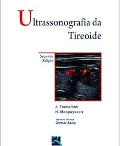 Ultrassonografia da Tireóide, 2nd Edition (PDF)