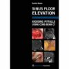 Sinus Floor Elevation: Avoiding Pitfalls Using Cone-beam CT (Scanned PDF)