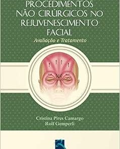 Procedimentos não Cirúrgicos no Rejuvenescimento Facial: Avaliação e Tratamento, 1st Edition (EPUB)