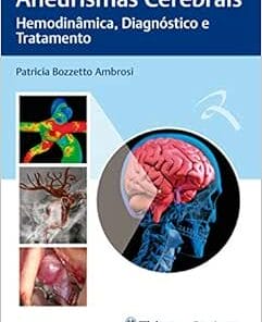 Aneurismas Cerebrais: Hemodinâmica, Diagnóstico e Tratamento, 1st Edition (PDF)