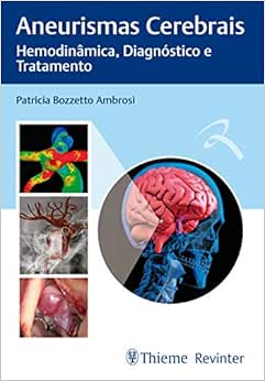 Aneurismas Cerebrais: Hemodinâmica, Diagnóstico e Tratamento, 1st Edition (PDF)