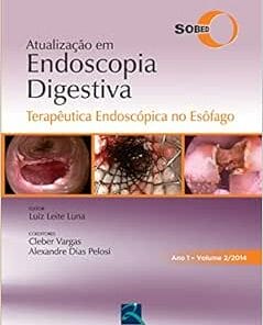 SOBED Atualização em Endoscopia Digestiva – Volume 2: Terapêutica Endoscópica no Esôfago – Ano 1, 1st Edition (EPUB)