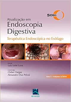 SOBED Atualização em Endoscopia Digestiva – Volume 2: Terapêutica Endoscópica no Esôfago – Ano 1, 1st Edition (EPUB)