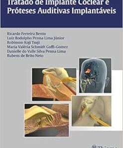 Tratado de Implante Coclear e Próteses Auditivas Implantáveis, 1st Edition (PDF)