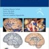 Neuroanatomia, 1st Edition (EPUB)