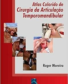 Atlas Colorido de Cirurgia da ATM, 1st Edition (EPUB)