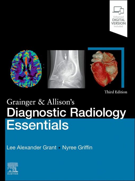 Grainger & Allison’s Diagnostic Radiology Essentials, 3rd edition (PDF)