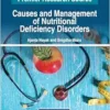 Causes and Management of Nutritional Deficiency Disorders (PDF)