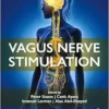 Vagus Nerve Stimulation (DPF)