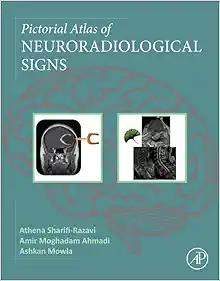 Pictorial Atlas of Neuroradiological Signs (PDF)