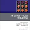 MR-Guided Focused Ultrasound, An Issue of Magnetic Resonance Imaging Clinics, Volume 32-4 (PDF)