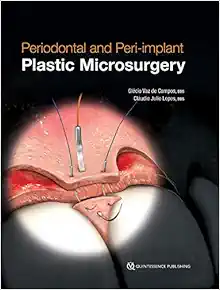 Periodontal and Peri-implant Plastic Microsurgery: Minimally Invasive Techniques with Maximum Precision (EPUB)