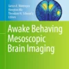 Awake Behaving Mesoscopic Brain Imaging: